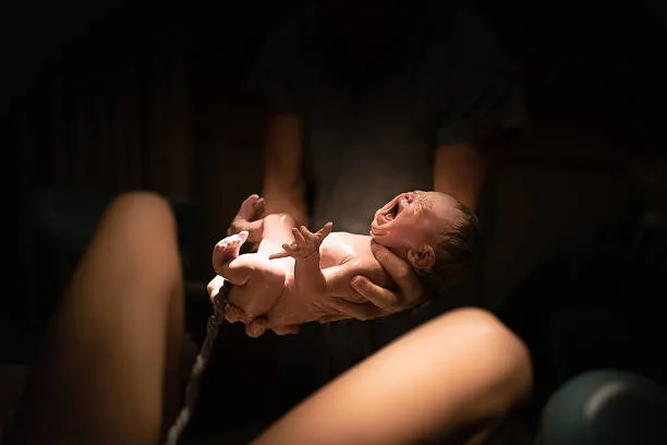 Doula na cesárea