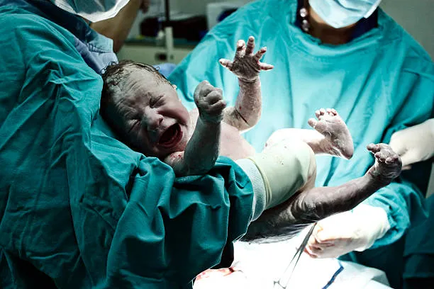 Doula no trabalho de parto